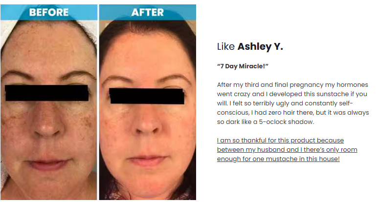 Admire My Skin Review