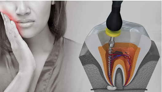 "Lady Facing Problem with Teeth Pain"