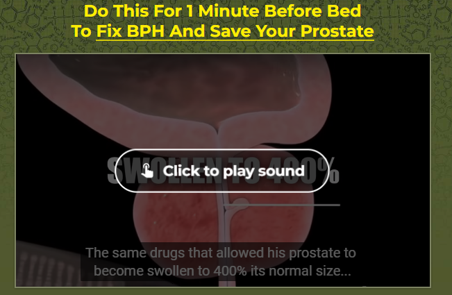 Prostate video