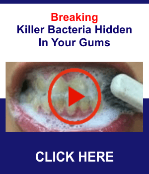 Renew Dental Support