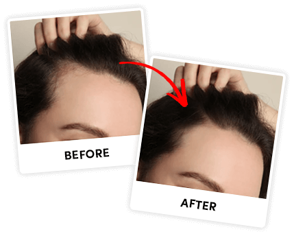 before and after hair solution
