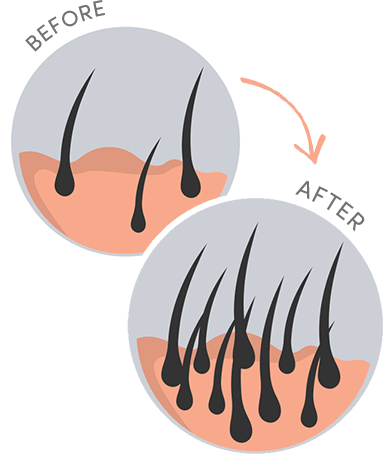 Revitalize before and after