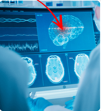 The Brain Song Reviews