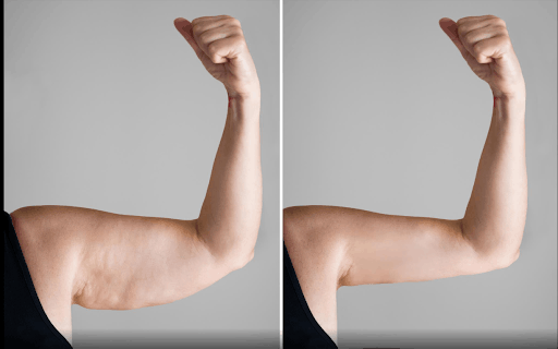 LeptiThin Max Review